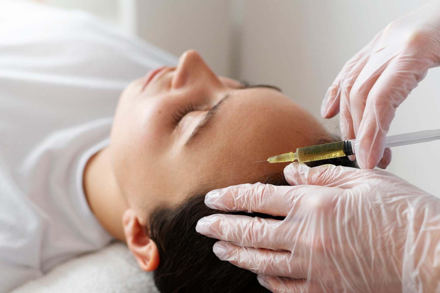 Mezoterapia skóry głowy 5ml 3+1 Gratis